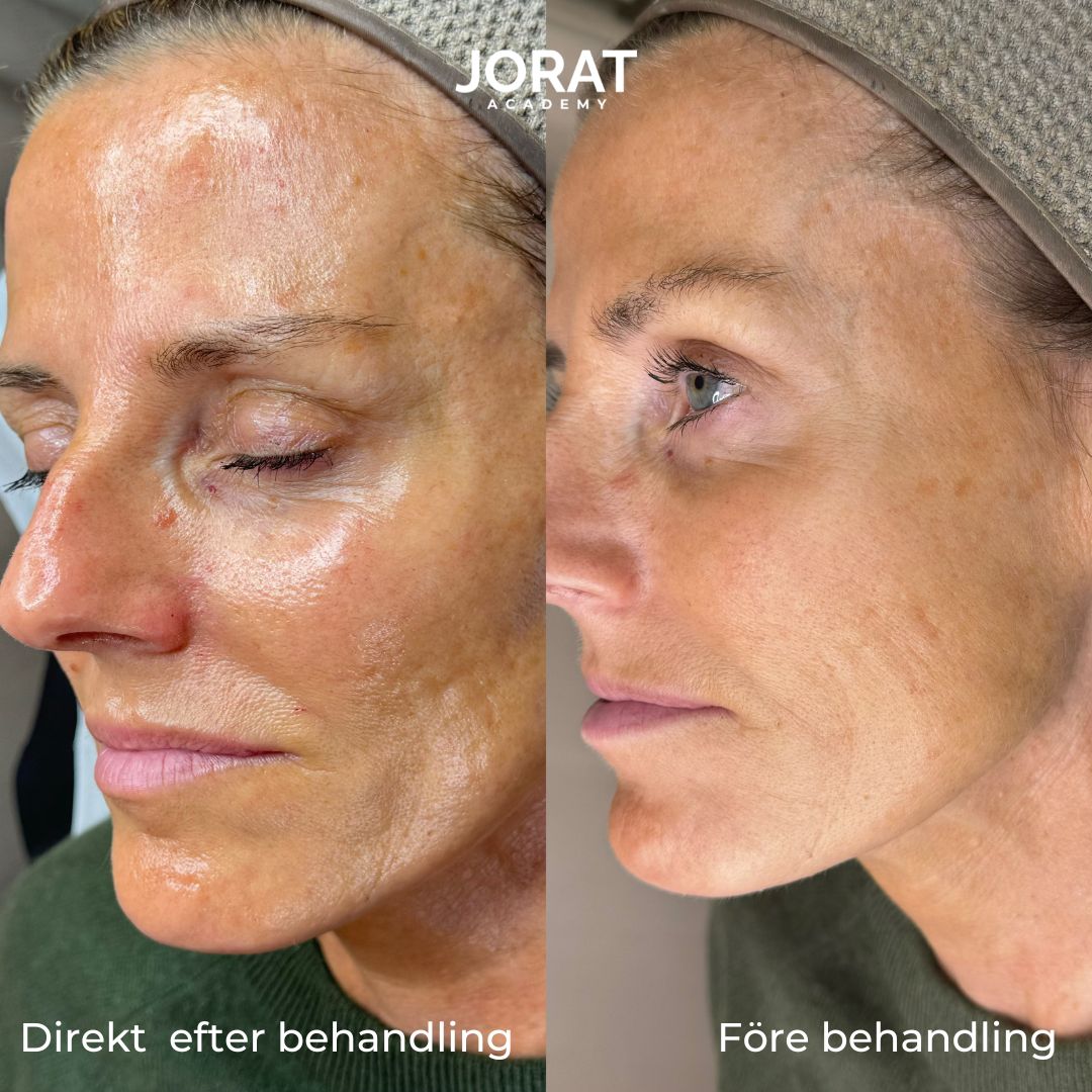 Glass Skin utbildning