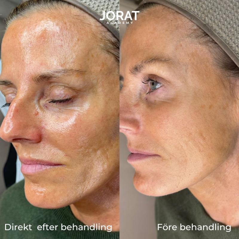 Glass Skin utbildning