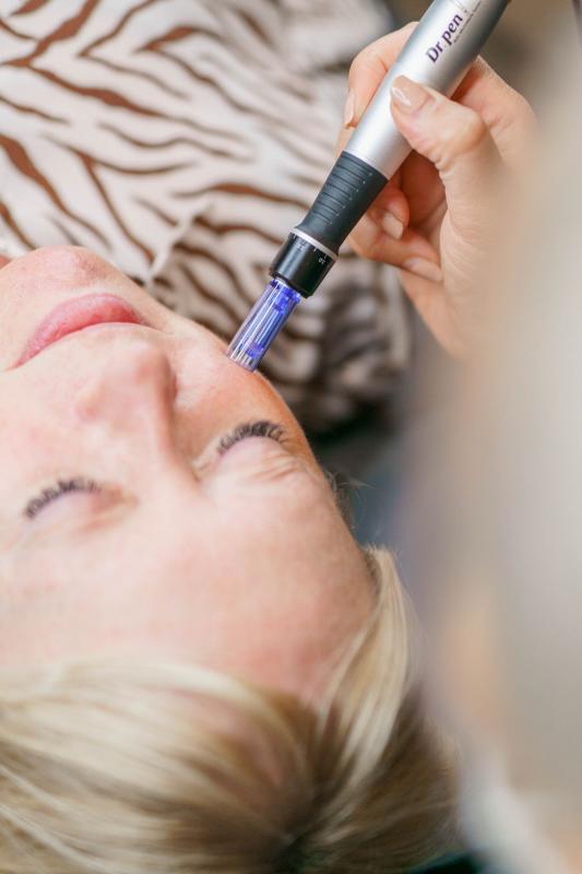 Bb-glow + kemisk peeling + microneedling