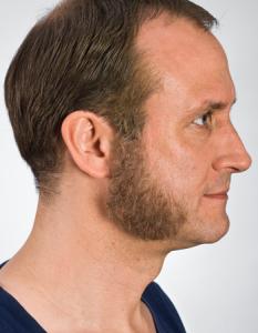 Sideburns Blond