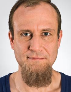 Chinbeard Blond