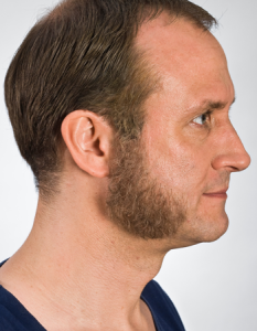 Sideburns Blond