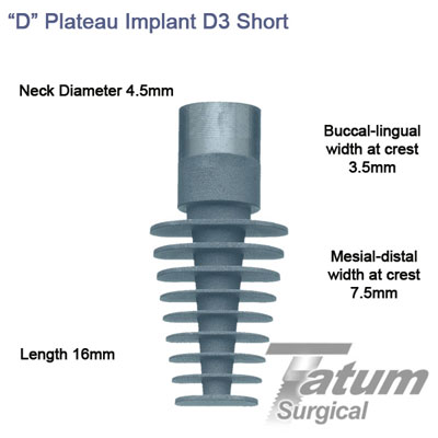 D Plateau Implants D3 4.5x16mm, Short mesial-distal 7.5mm