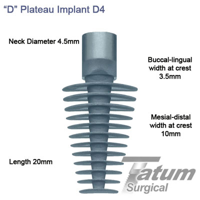 D Plateau Implants D4 4.5x20mm, Regular mesial-distal 10mm