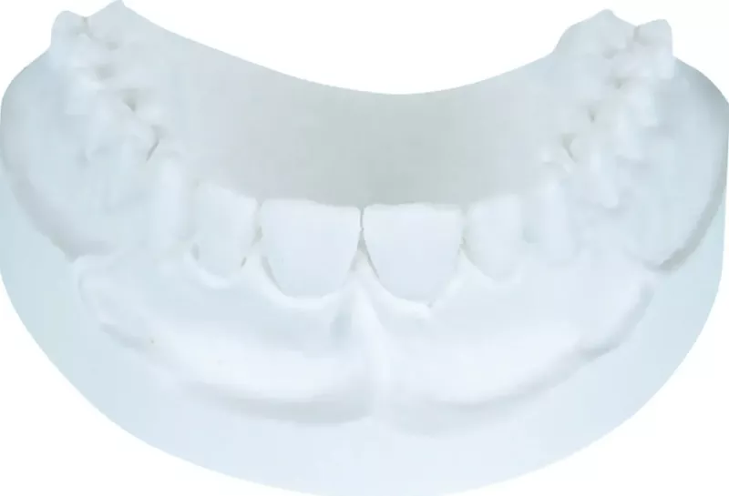 KFO-Dur Gips Brillant White 20kg