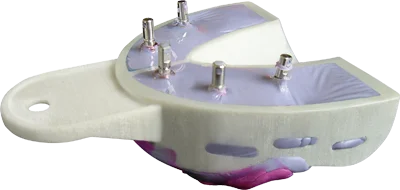 MiraTray Implant avtryckssked Small ÖK S1 6st