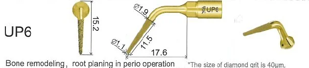Woodpecker Tip UP6 Perio Mectron