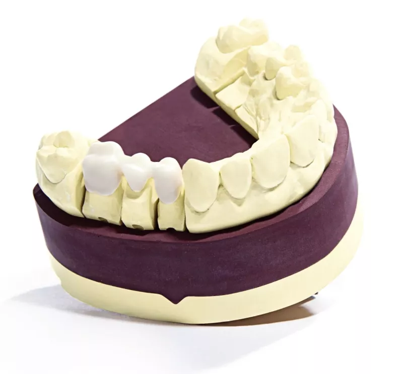 Esthetic-Base evolution ivory 25kg
