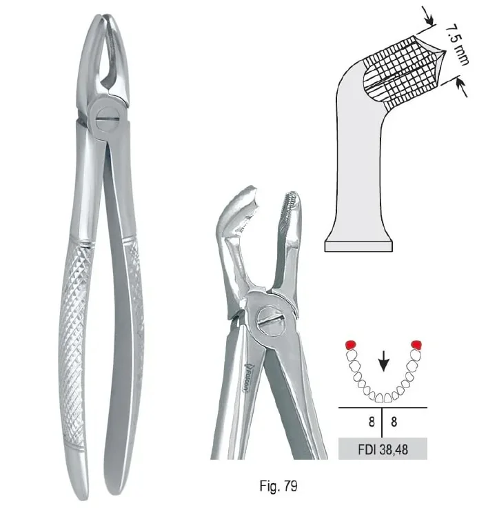 Extraktionstång European pattern fig. 79