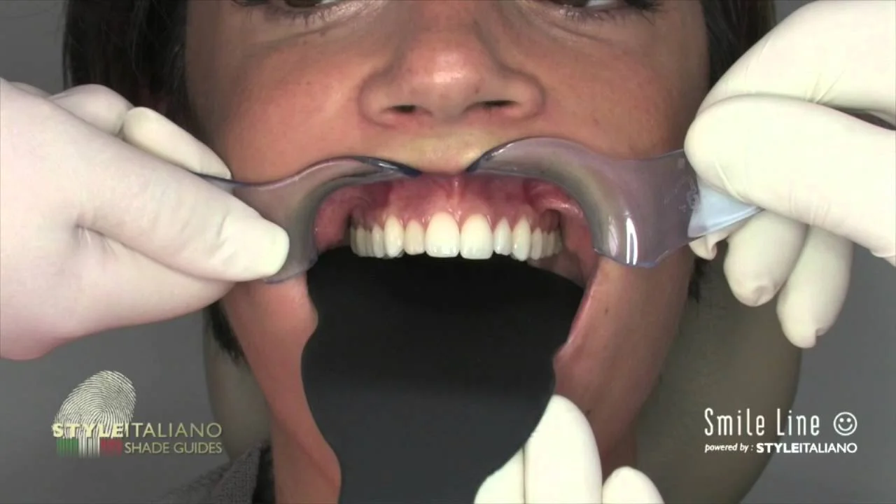 Flexipalette, form B