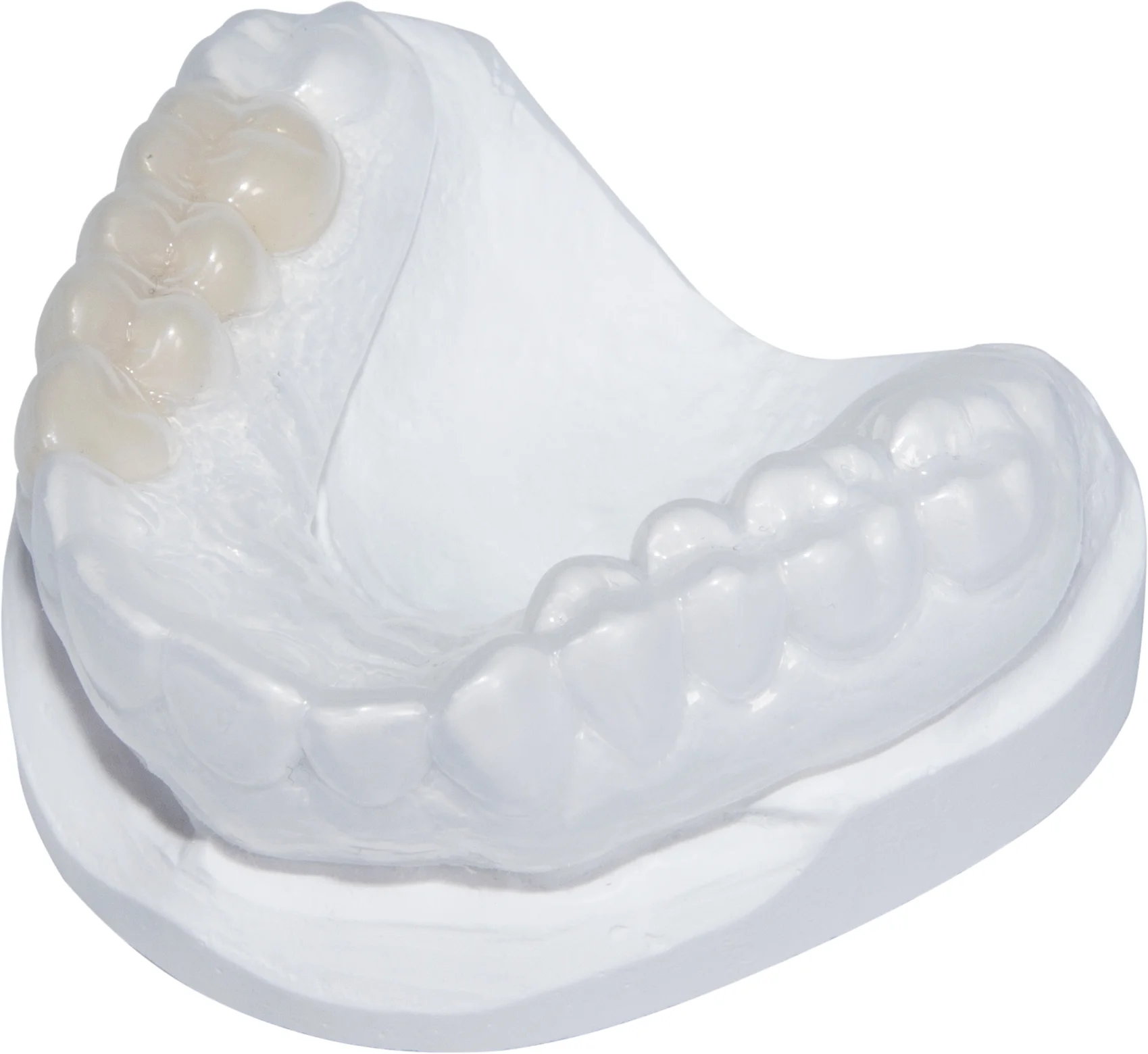 Erkolen, 2.00 mm, ò 120 mm, transparent 50 pieces