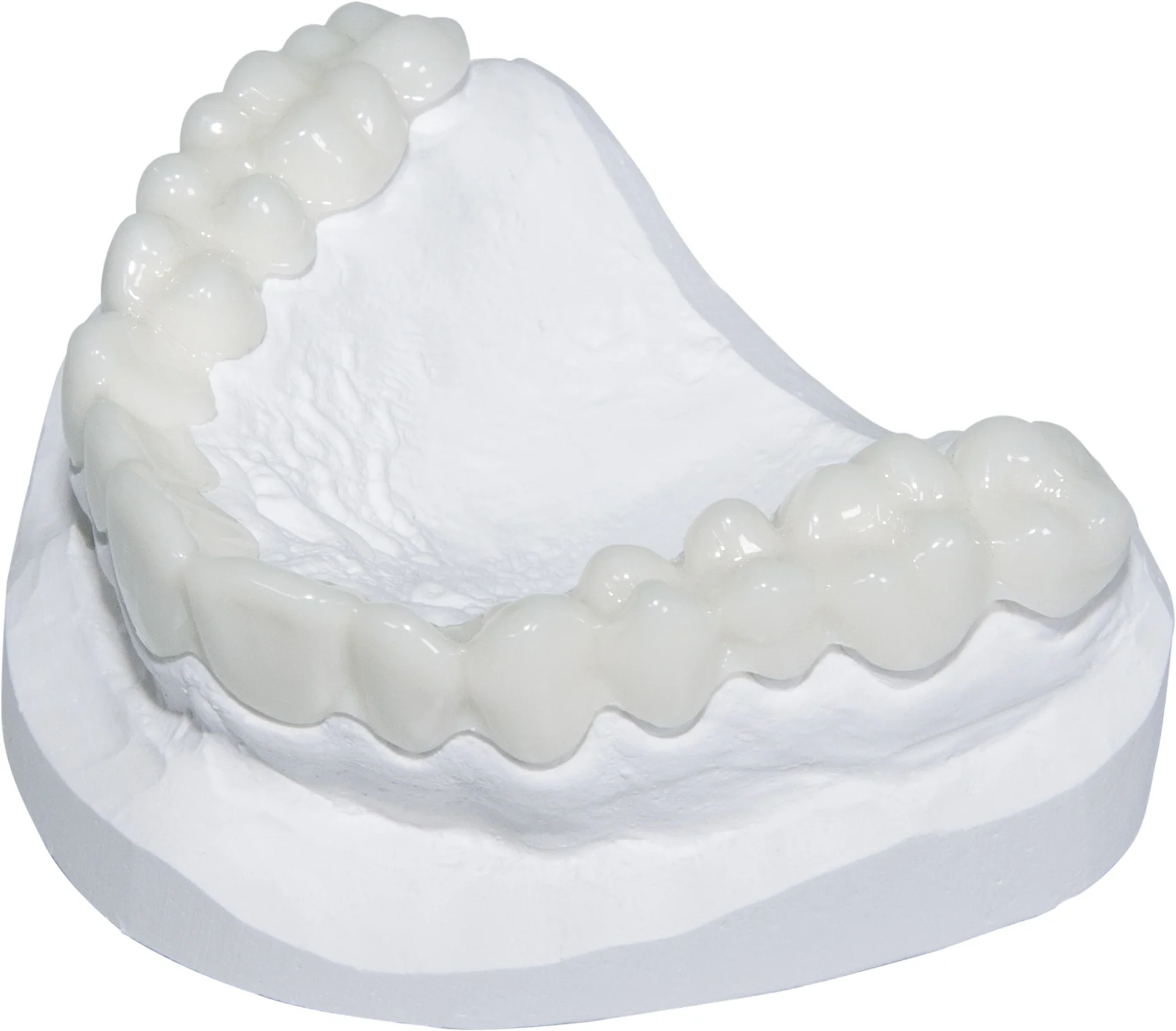 Erkodur-A1, 1.50 mm, ò 120 mm, tooth colour 10 pieces