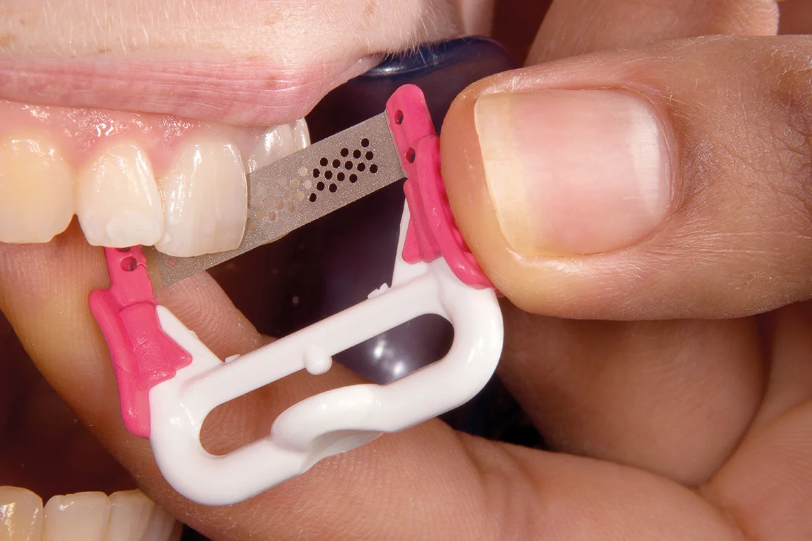 NTI - ProxyStrip (röd-fin) -  FS5-FKP -  10-pack