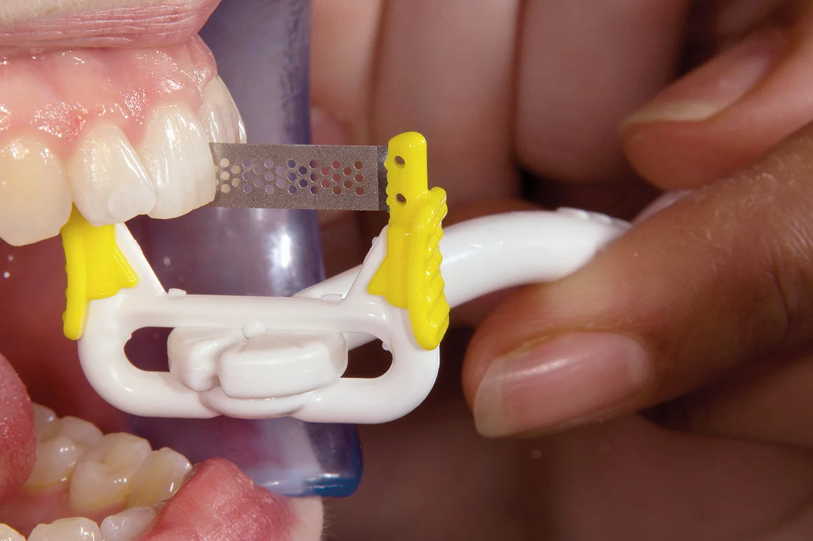 NTI - ProxyStrip (gul-superfin) -  FS5-SFKP -  10-pack