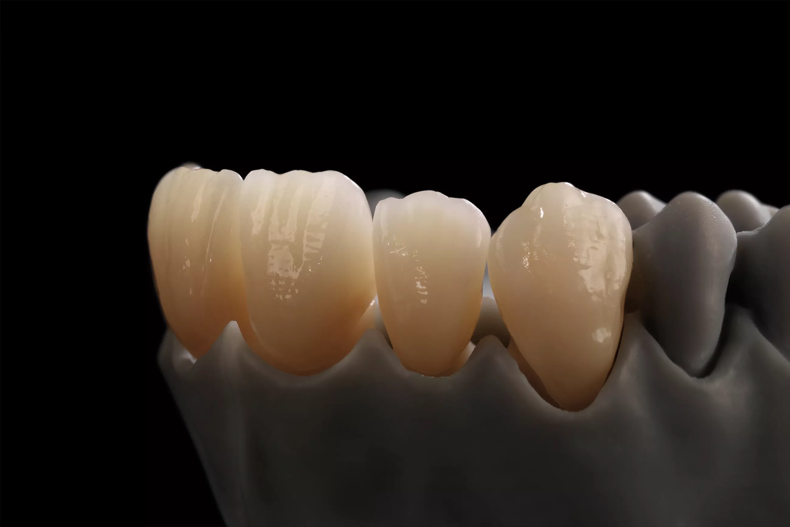 Zolid Gen-X 25mm. (Frame) Multilayer för alla indikationer