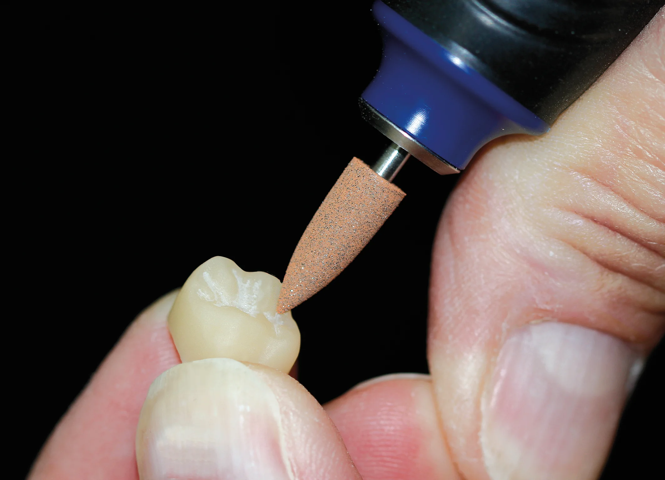 NTI - PMMA & PEEK polerare- P0614- 1-pack