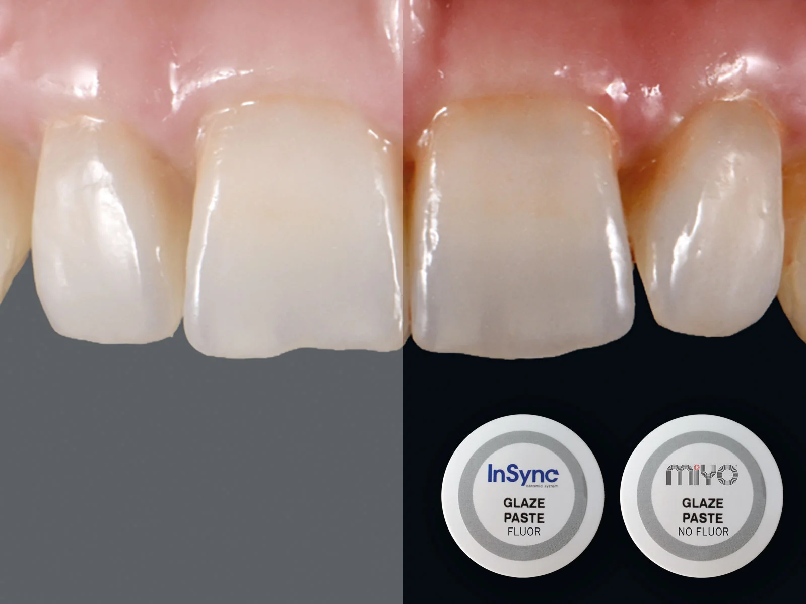 InSync Glaze Paste Fluor, 4g