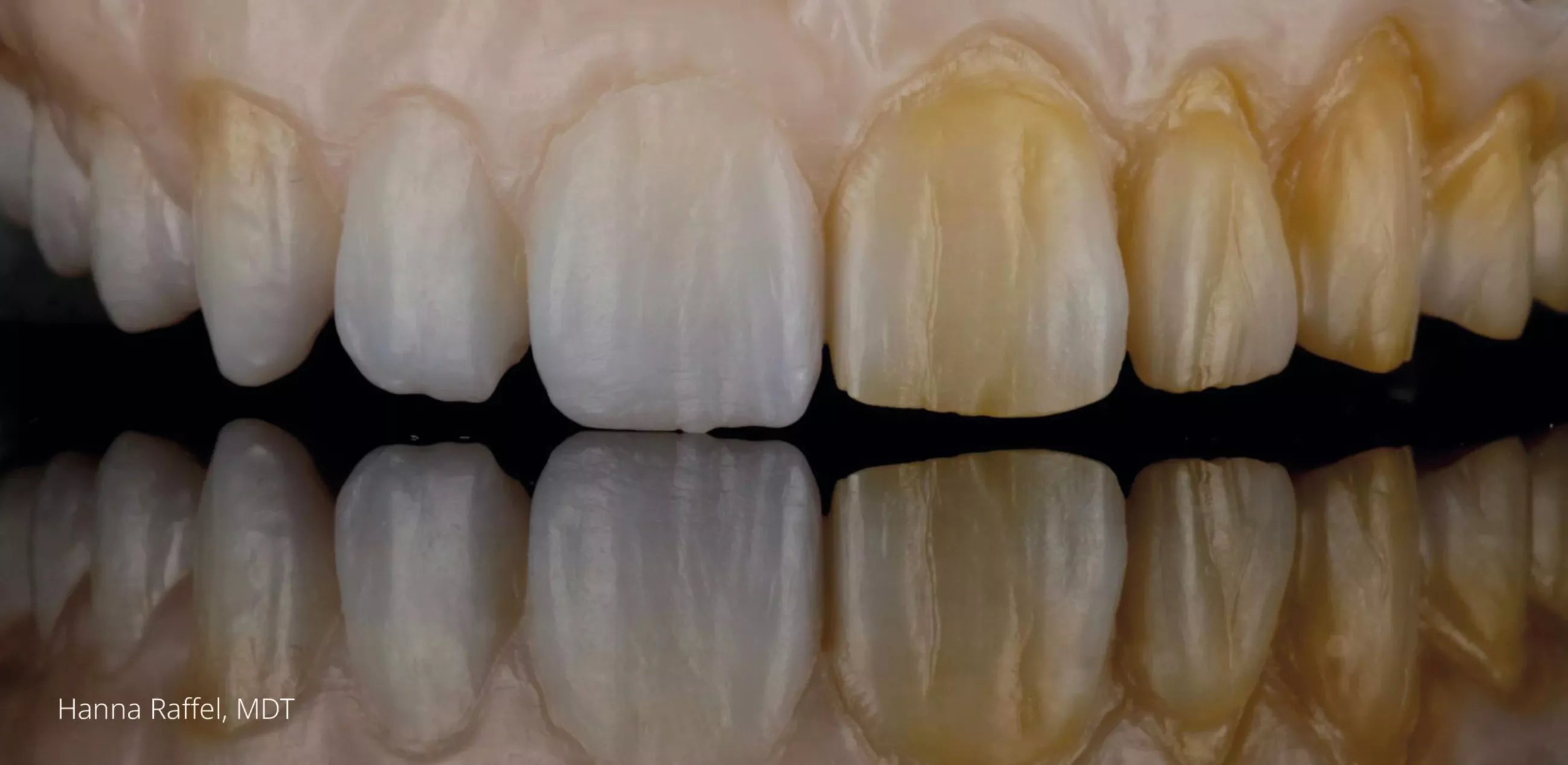 Zolid Naturals Dimmer (50ml)