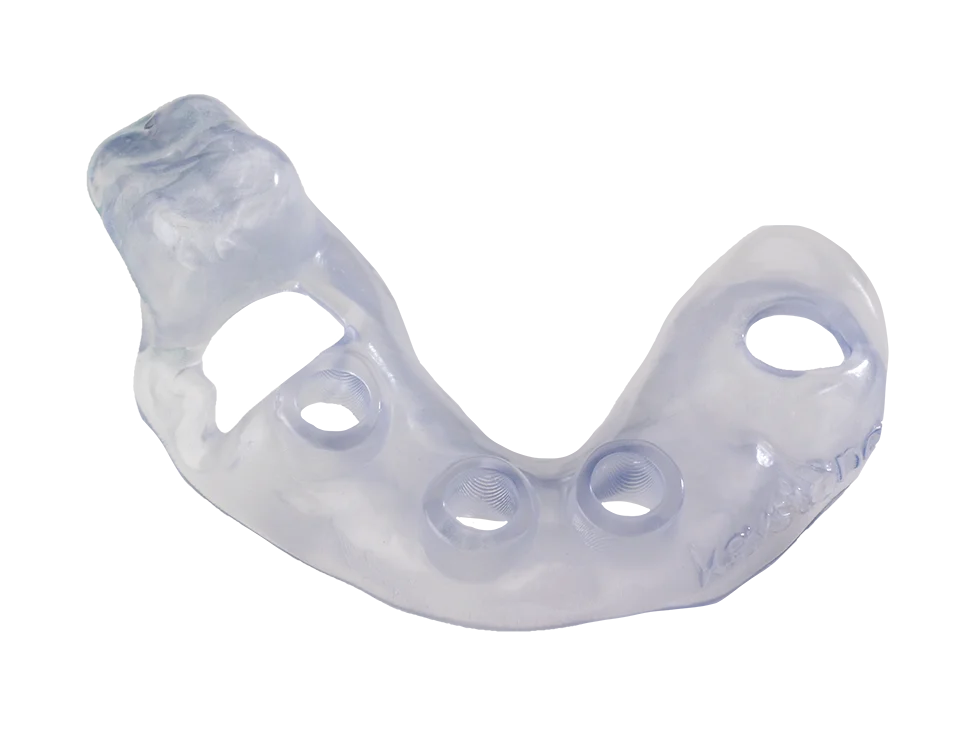 KeyGuide - Transparent - 1KG/MDI