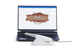 Intraoral Scanner Fussen S6500