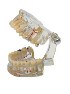 Modell Transparent Plus