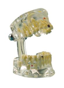 Modell Transparent Child