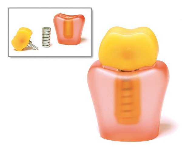 Modell Entandsimplantat