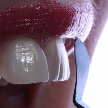 CASI kompositinstrument 3C bred