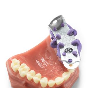 Temporary Tray, 100 st/frp