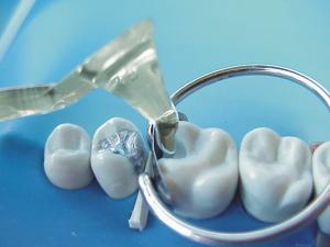 Contact Gold small+large, 2 st