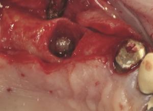 Strauss Degranulation Kit