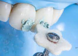 Lucida felt stars, filttrissor 100 st