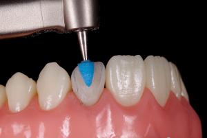 FlexiPoints,6 st/frp