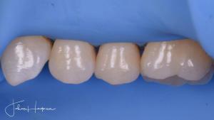 Modern kompositteknik. Heldagskurs (teori). Stockholm. 5 december 2025