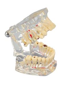 Modell Transparent de Luxe