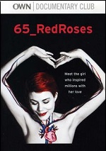 65 Redroses