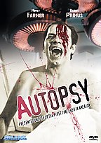 Autopsy