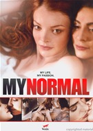 My Normal