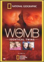 In The Womb - Identical Twins