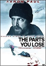 Parts You Lose