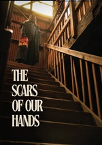 Scars Of Our Hands