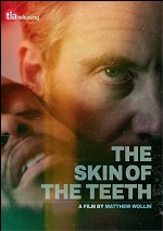 Skin Of The Teeth