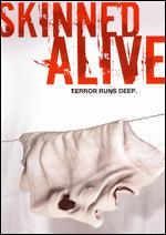 Skinned Alive