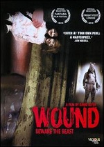 Wound