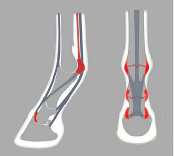 ACR 2150 Hind Asymmetric Shoe, Parpris