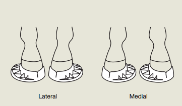 Dallmer Fölkorrigeringsskor Modell EXT, Parpris