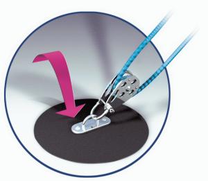 TBS SPEEDGRIP 1200MM x1400 MM SK