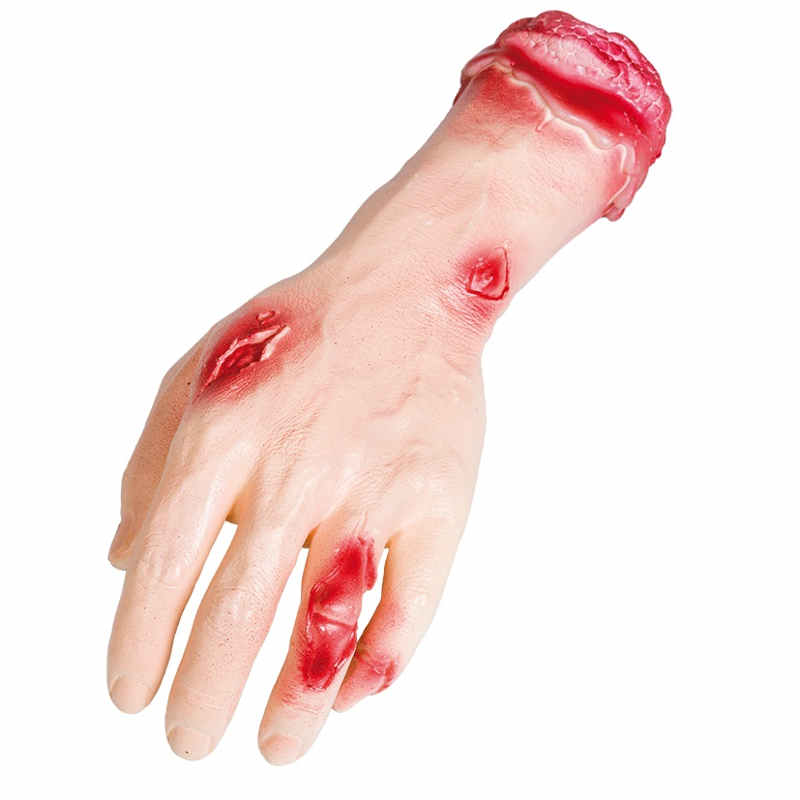 Sårad hand