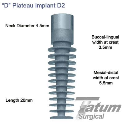 D Plateau Implants D2 4.5x20mm, Regular mesial-distal 4.5mm