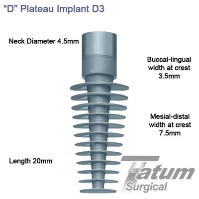 D Plateau Implants D3 4.5x20mm, Regular mesial-distal 7.5mm